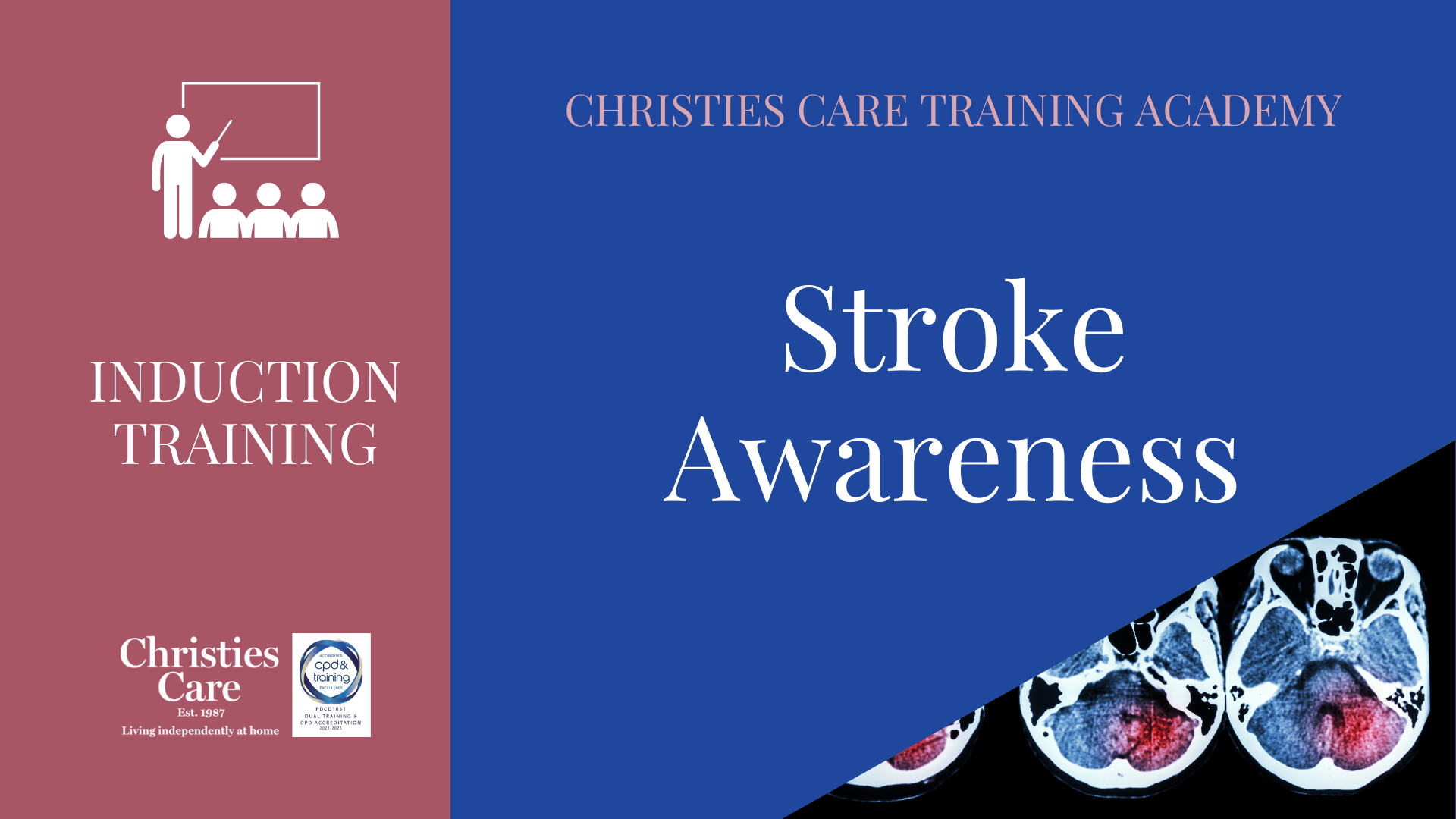 STROKE AWARENESS SA2026